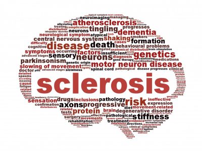 cbd olie tegen zikete multiple sclerosis (MS)